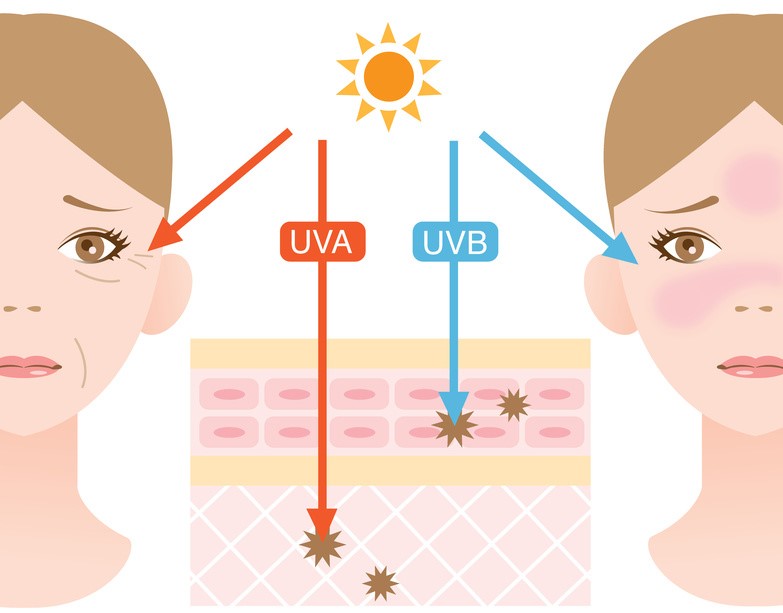 Tia UV ảnh gây lão hóa vùng da quanh mắt