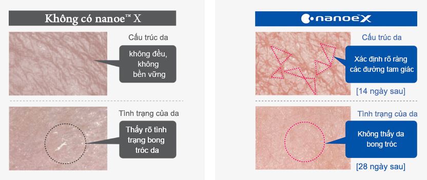 Cấp ẩm cho da - Công nghệ NanoeX