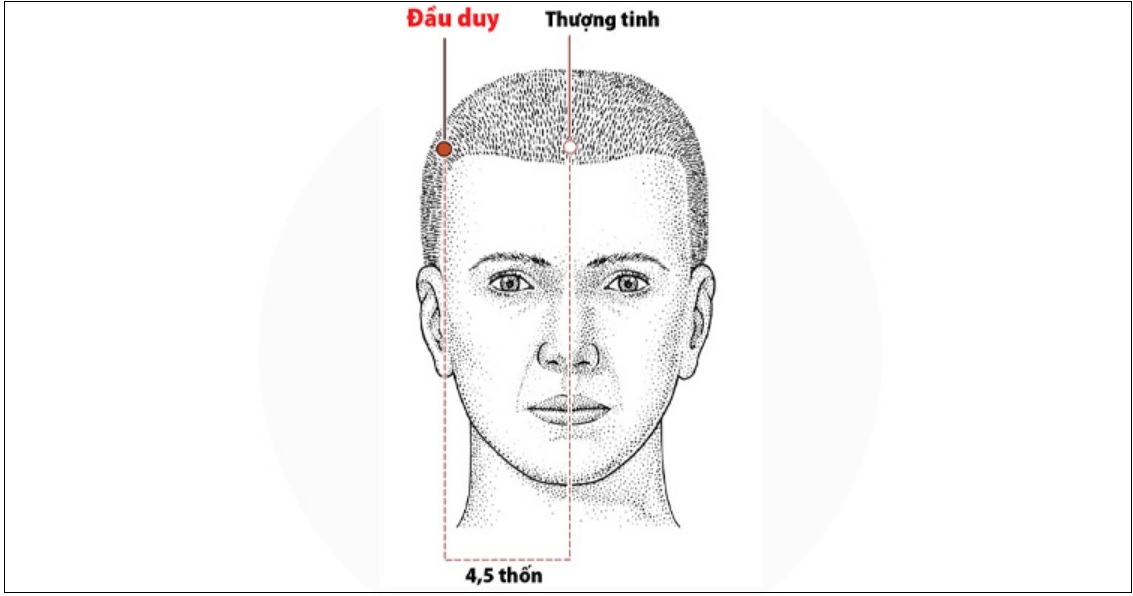 Huyệt đầu duy