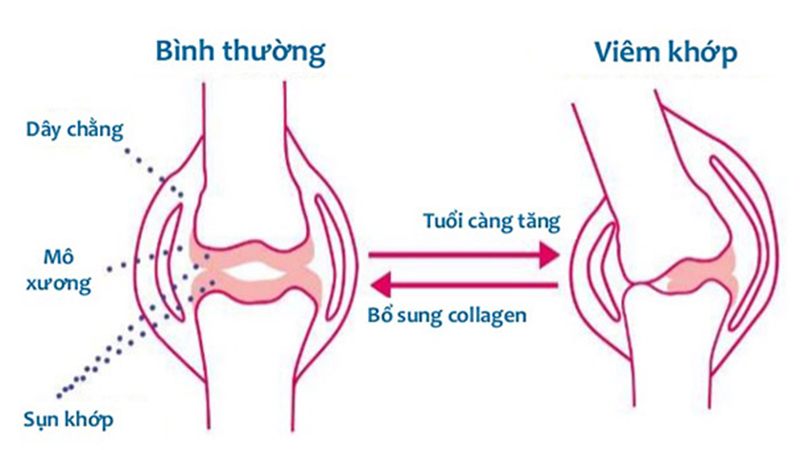 Collagen là gì? Tác dụng của collagen với làn da và cơ thể như thế nào